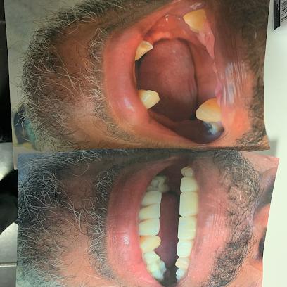 AApoLLo Dental Centers - General dentist in Atlanta, GA