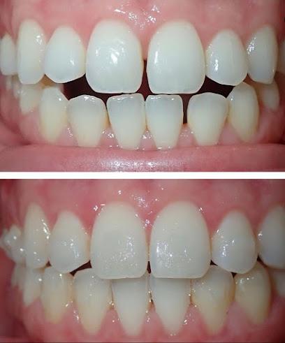 Shiney Smiles Orthodontics - Orthodontist in Huntington, NY
