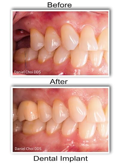 North Texas Dental Surgery Wisdom Teeth and Denture Implant Center - General dentist in Grapevine, TX
