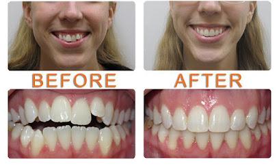 Viva Smiles - Orthodontist in Garden Grove, CA