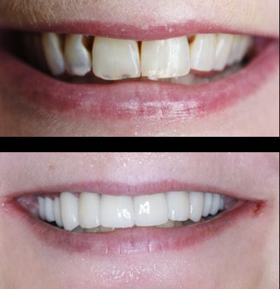Fresh Leaf Dental - General dentist in Tustin, CA