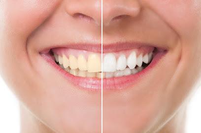 Schroeder & Schroeder Dentistry - General dentist in Indianapolis, IN
