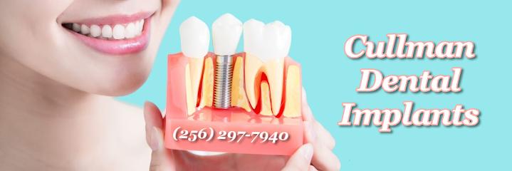 Cullman Dental Implants - Periodontist in Cullman, AL