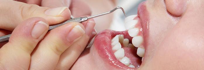 Best Implants NJ - General dentist in Lyndhurst, NJ