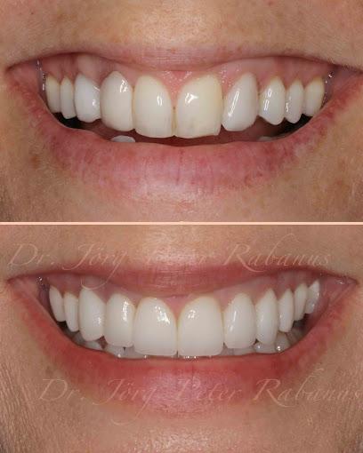 Dr. Jorg-Peter Rabanus, DDS - Cosmetic dentist, General dentist in San Francisco, CA