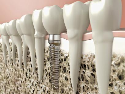 Implant and Periodontal Professionals - Periodontist in Rochester, MN