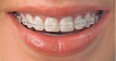 Chapman Orthodontics - Orthodontist in Mitchell, IN
