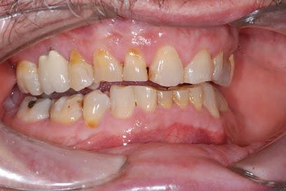 TMJ Headache Treatment Center - General dentist in Danbury, CT
