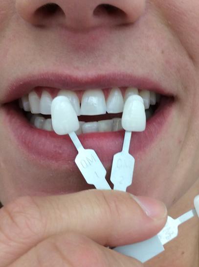 Dental Excellence: Dr. Brett Noorda - General dentist in Henderson, NV
