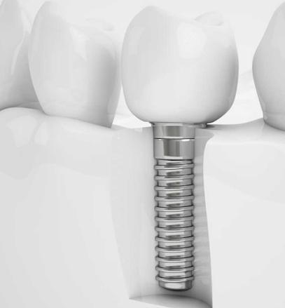 Sutor Periodontics & Dental Implants - General dentist in Bloomington, IN