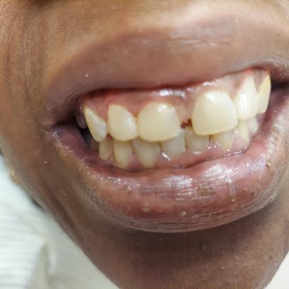USmile dental (Dr Zhuozhao Mei) - General dentist in Silver Spring, MD