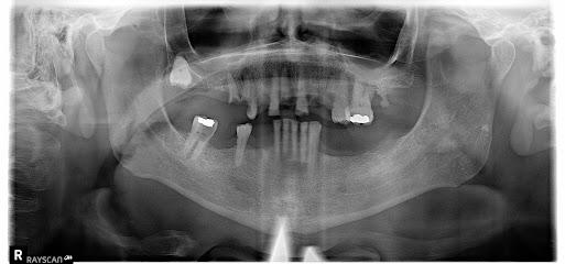 Ora Dental Implant Studio - Periodontist in Elk Grove, CA