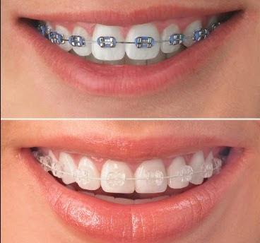 Hollywood Smile Dental - General dentist in Rockville Centre, NY