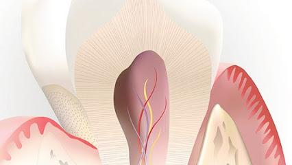 Sacramento Root Canal Specialists - Endodontist in Sacramento, CA