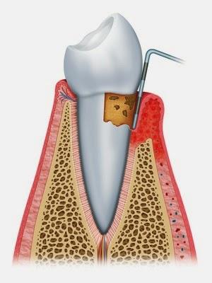 Keystone Dental Center - General dentist in Colorado Springs, CO
