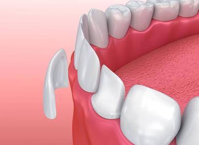 Sunnyside General Dentistry - Pediatric dentist in Clackamas, OR