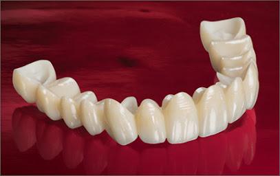 Extra Mile Dentist - Cosmetic dentist in Roswell, GA