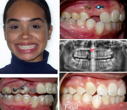 Diamond Braces Orthodontist: Braces & Invisalign - Orthodontist in Bronx, NY