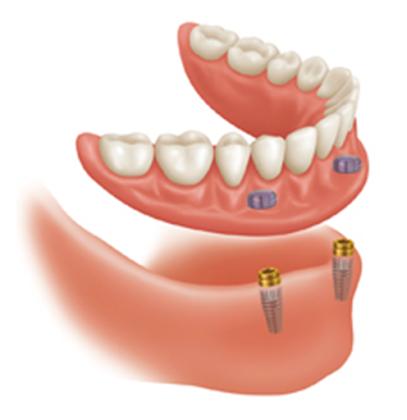 Dayton Dental Group - General dentist in Dayton, OH