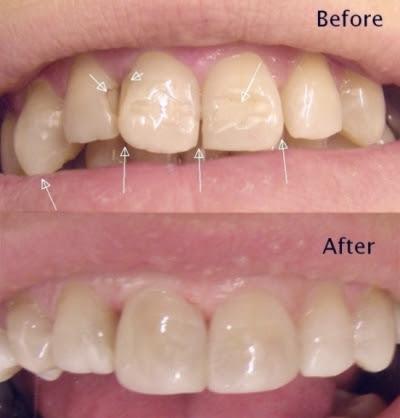 Dr. Spencer R. Bloom, DDS - General dentist in Chicago, IL