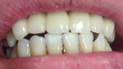 Q Dentistry - General dentist in Everett, WA