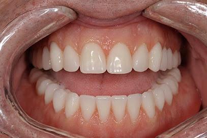 Fred H. Peck, DDS - Cosmetic dentist in Cincinnati, OH