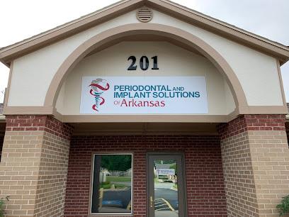 Periodontal and Implant Solutions of Arkansas - Periodontist in Rogers, AR