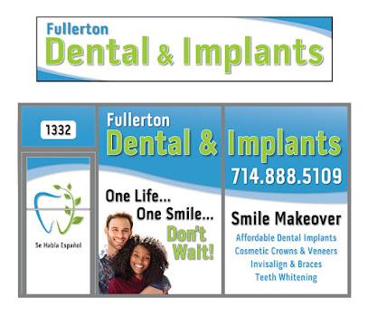 Fullerton Dental & Implants - General dentist in Fullerton, CA
