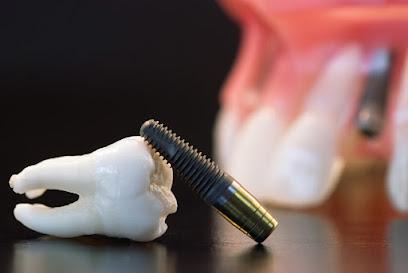 Denture Implants - Periodontist in Delmar, NY