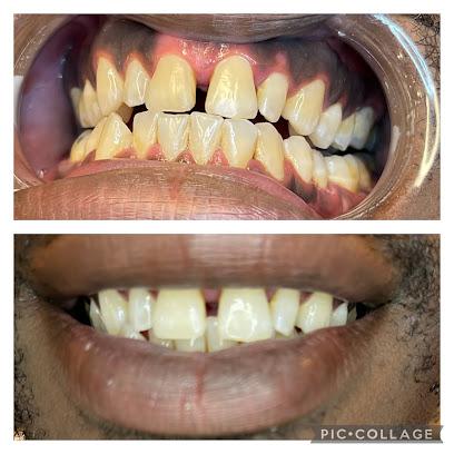 Royal Whites Mobile Teeth Whitening - Cosmetic dentist, General dentist in San Diego, CA
