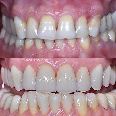 Allure Dental Chicago - General dentist in Chicago, IL