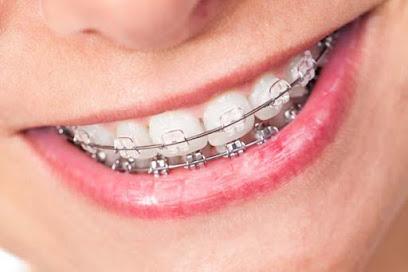 Yang Orthodontics – Invisalign & Braces in Newtown - Orthodontist in Newtown, PA