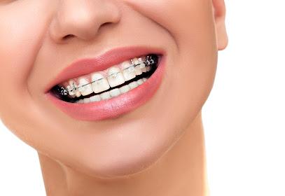 Northeastern Braces - Orthodontist in Bronx, NY