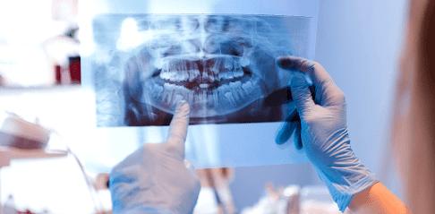 Complete Dentistry: Diana Millard, DMD - General dentist in Charlotte, NC