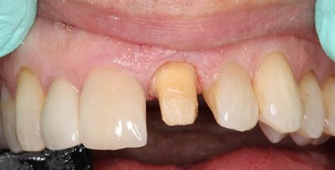 La Mesa Smiles & Implant Dentistry - General dentist in La Mesa, CA