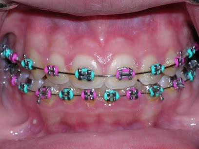 Hudson County Orthodontics: Messana Michael M DDS - Orthodontist in Bayonne, NJ