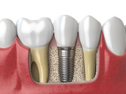 Premier Periodontics – Implant & Sedation Dentistry - Oral surgeon in Red Bank, NJ
