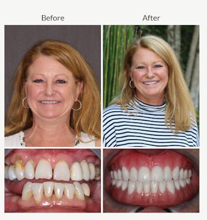 Beyond Exceptional Dentistry - Cosmetic dentist in Savannah, GA