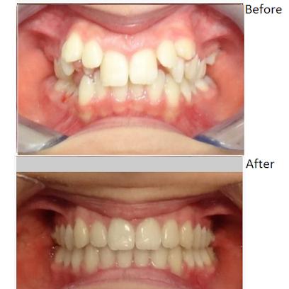 Abington emergency and Implant dentist - General dentist in Abington, PA