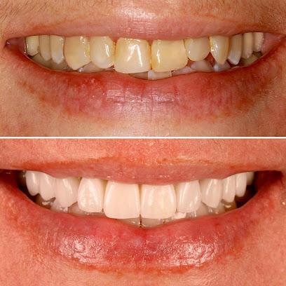 Draper Smiles – Dr. Fernando Pessoa: World-Class Dentistry - General dentist in Draper, UT