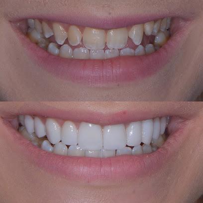 Dental Implants Cleveland - General dentist in Rocky River, OH