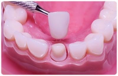 Dedicated Dentistry - General dentist in Denver, CO