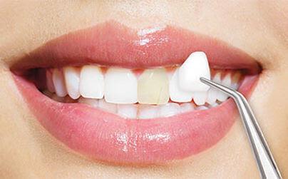 Irvine Smile Dentistry - General dentist in Irvine, CA