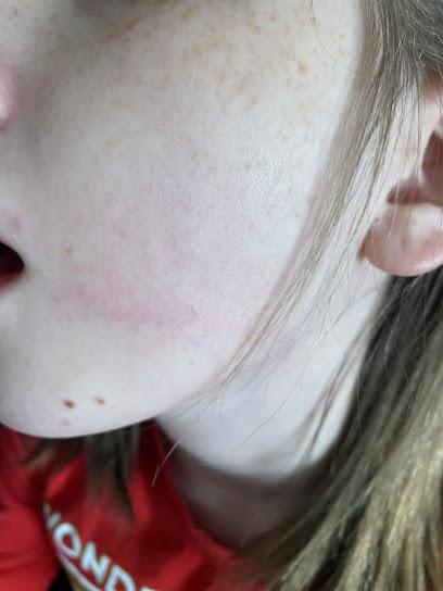 Felicia Do Family Dentistry - General dentist in Lamont, CA