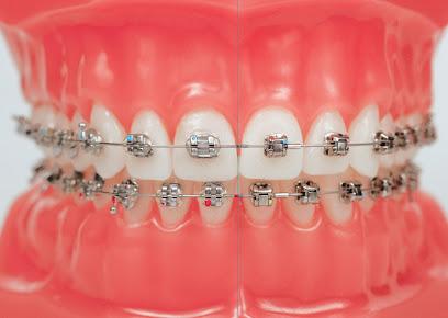OrthoMike Orthodontics – Braces & Invisalign for Adults and Children - Orthodontist in Boca Raton, FL