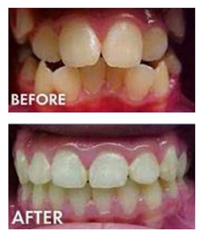 Cool Smiles Orthodontics – Perris - Orthodontist in Perris, CA