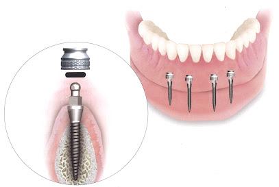 Toups Family Dentistry - General dentist in Lafayette, LA