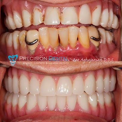Precision Dental - General dentist in Glendale, CA