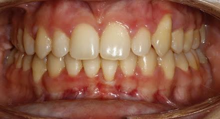 Richard D Christensen DDS, MS | RCOrtho - General dentist in Yakima, WA