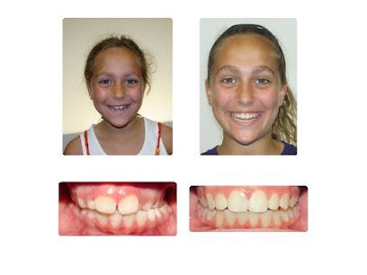 Lippitz Orthodontics - Orthodontist in Chicago, IL